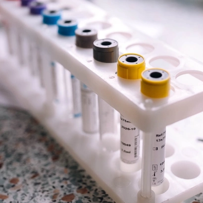 Забір крові для аналізу печінкових проб