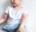 Hives in children: how to recognize and how to treat hives in children