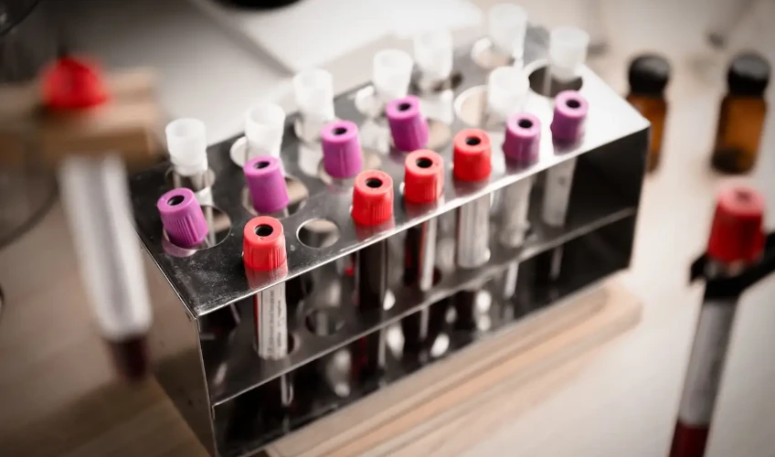 аналізи при затримці росту у дітей